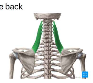<p>Levator Scapula: F</p>