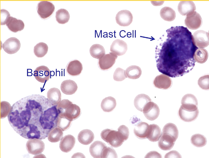 <p>Basophils → segmented nuclei</p><p>Mast Cells → round nuclei</p>