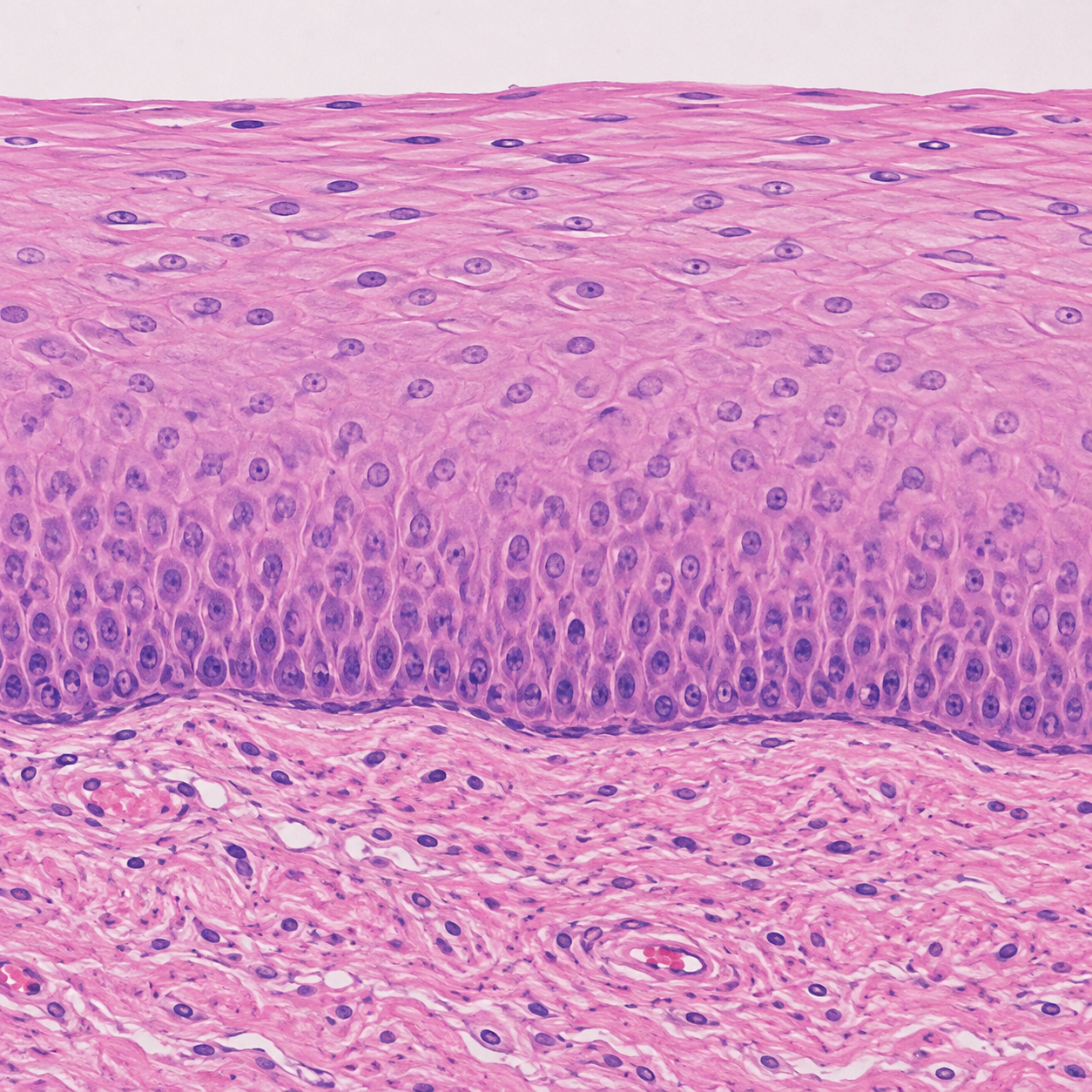 <p>What type of Epithelial Tissue is this?</p>