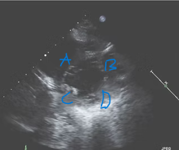 <p>What segment is at B? </p>