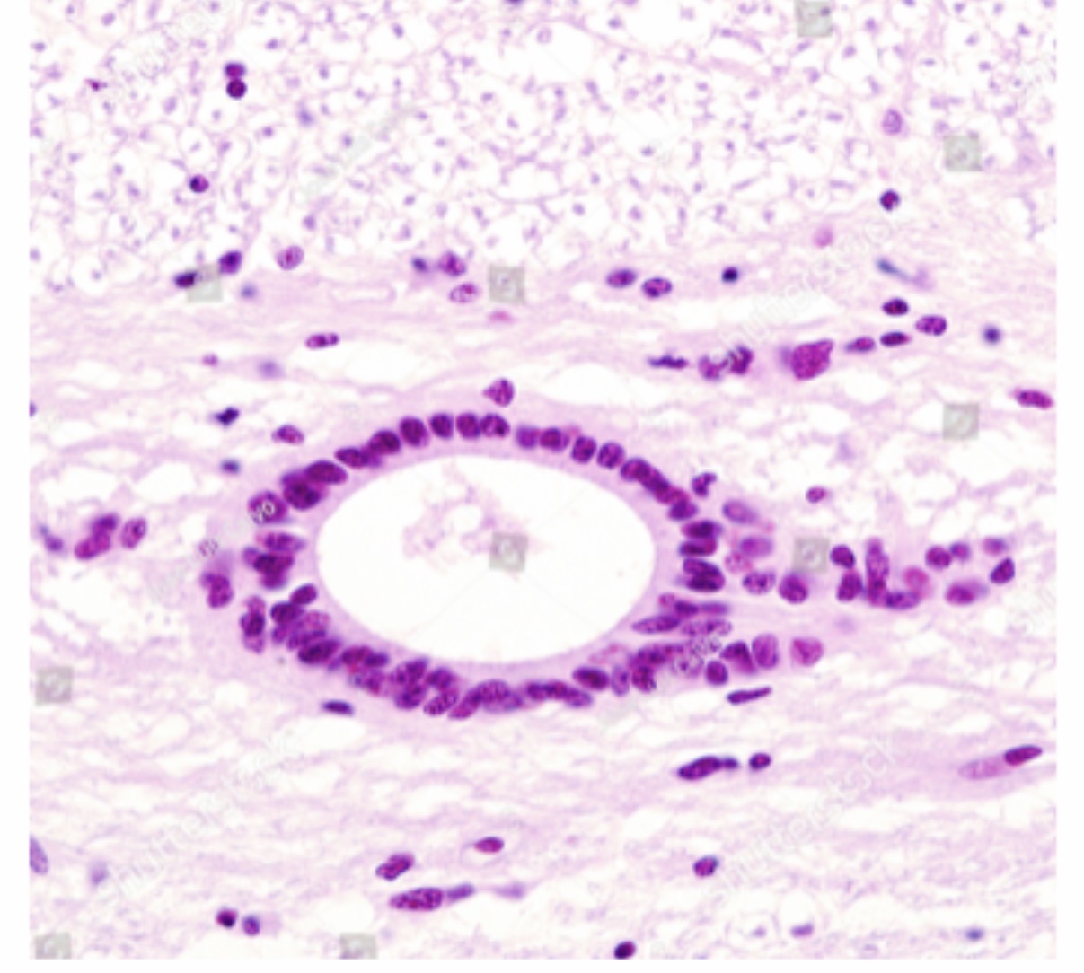 <p><span>Ependymal cells: Function and etc: Line the ventricles and central canal and produce and circulate cerebrospinal fluid (CSF). They are ciliated glial cells and form part of the choroid plexus.</span></p>