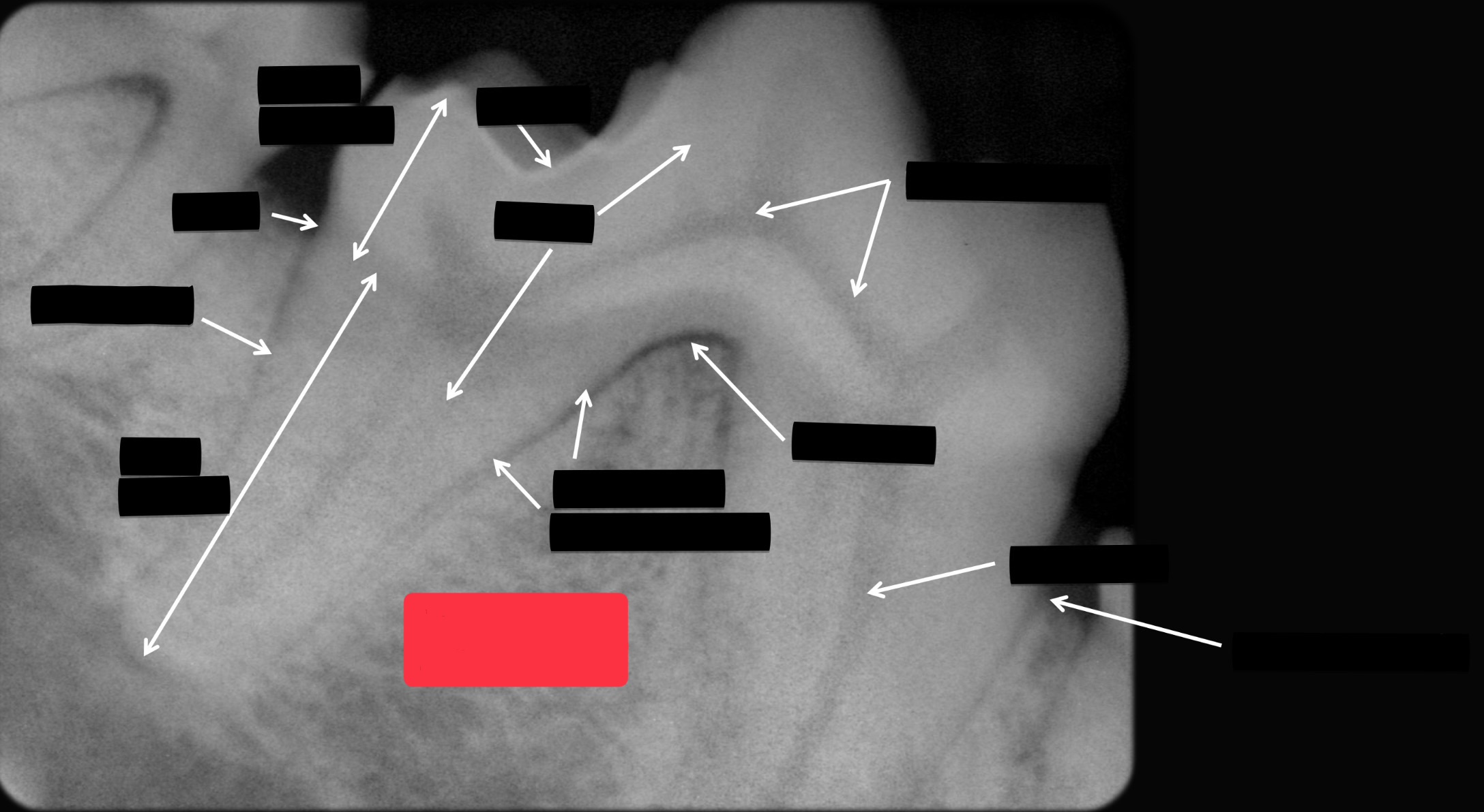 <p>Label this part of the tooth.</p>