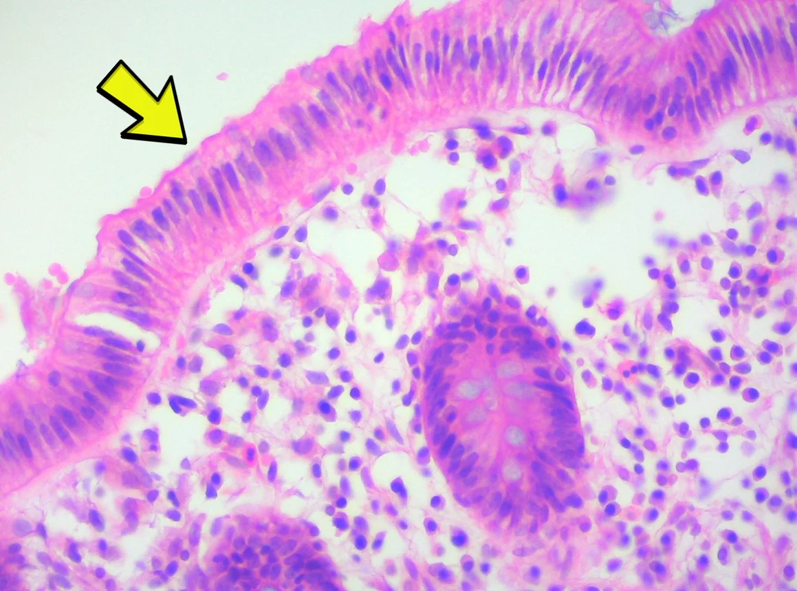 <p><span>Identify the tissue type in the micrograph at the yellow arrow.</span></p>
