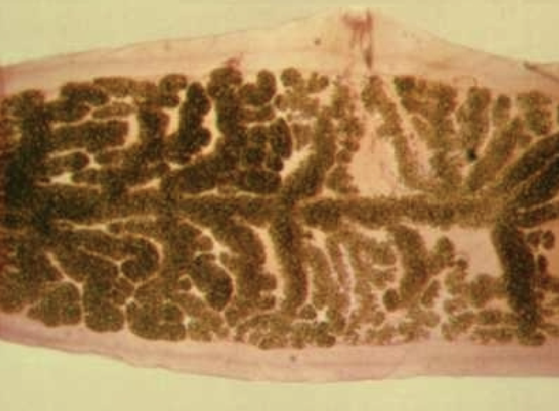<p>What cestode/tapeworm/parasitic worm is this?</p>
