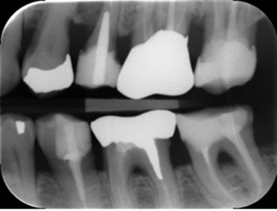 <p><span style="font-family: Calibri, sans-serif;"><strong>Vurder skarpheden på billedet</strong></span></p>