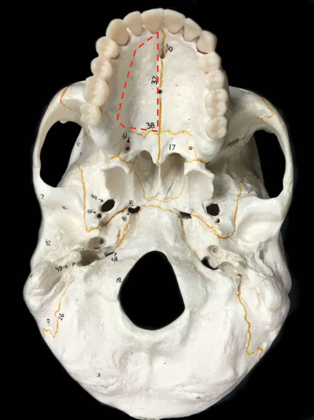 <p>Identify what’s highlighted in red</p>