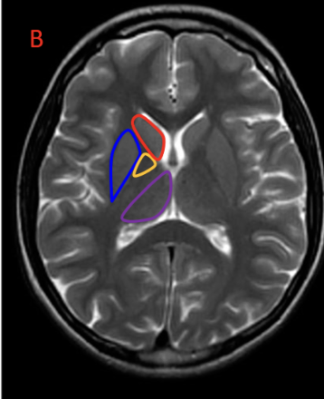 <p>Name the highlighted areas</p>