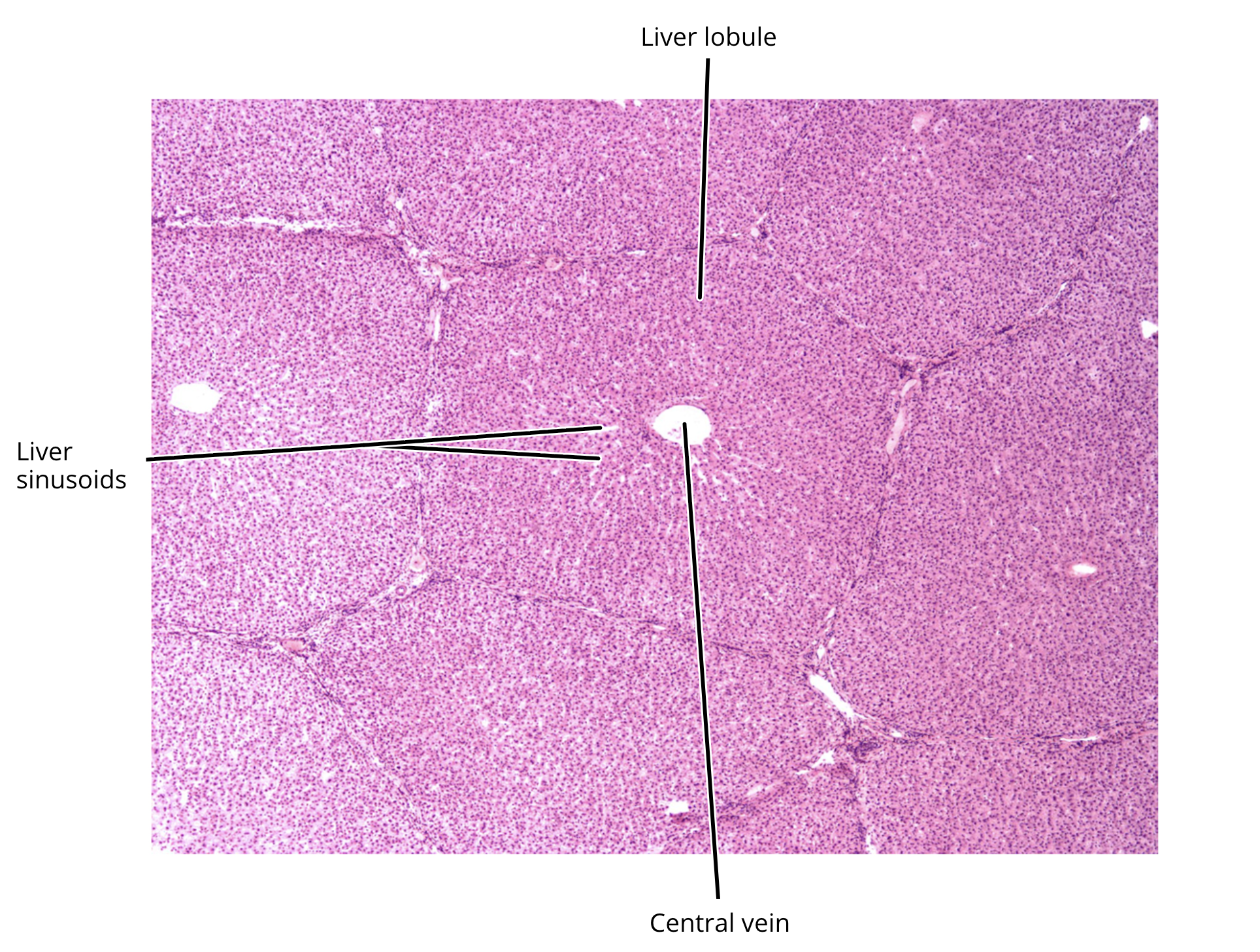 <ul><li><p>lobule </p></li><li><p>central vein of lobule</p></li></ul><p></p>