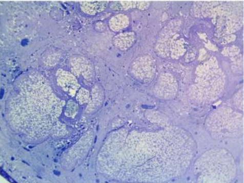 <p>mode of secretion of meibomian glands and identify the stuctures on a microscopic section</p>