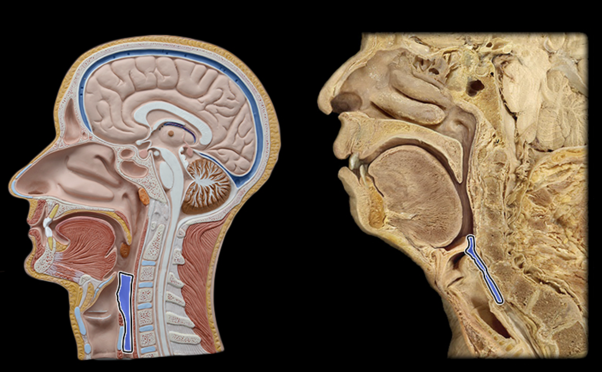 <p>Laryngopharynx</p>