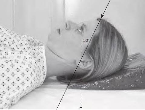 <p>AP axial skull projection used to visualize the occipital bone, petrous pyramids, dorsum sellae, and posterior clinoid processes within the foramen magnum</p>
