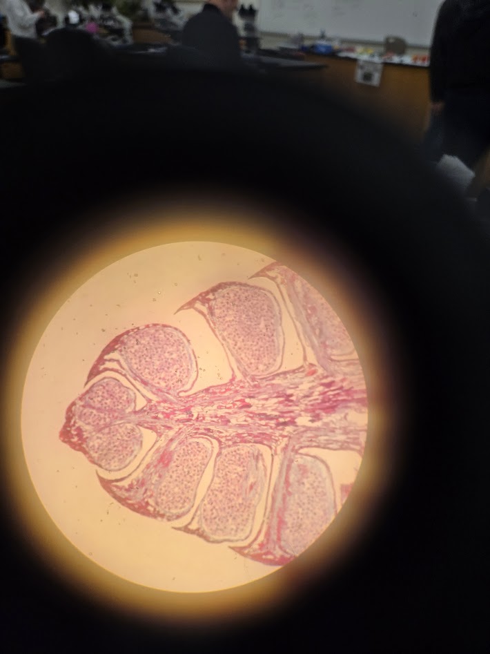 <ol><li><p>what is the phylum?</p></li><li><p>what is the structure?</p></li><li><p>what is the ploidy of the dots inside the wing/leaf looking things?</p></li></ol><p></p>