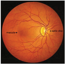 <p>A <span>raised spot on the retina where nerve fibers meet to form the optic nerve</span></p>