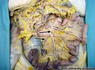 <p>what artery is pictured?</p>