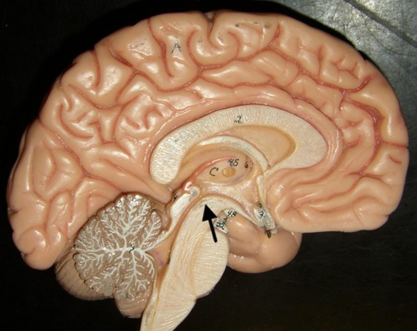 <p>A smaller area superior to the pons and inferior to the diencephalon, consisting of cerebral peduncles and the corpora quadrigemina.</p>