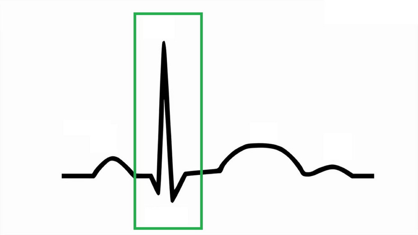 <p>ventricular depolarization (contraction); tells ventricles to contract; atria relaxes here</p>