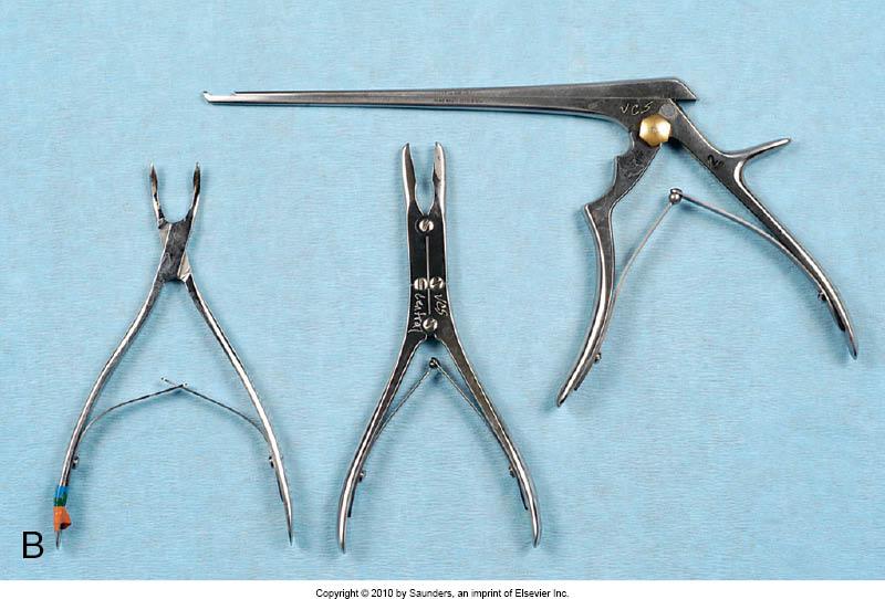 <p><span style="background-color: transparent;">Left to right: Single-action rongeur, double-action rongeur, Kerrison rongeur</span></p>