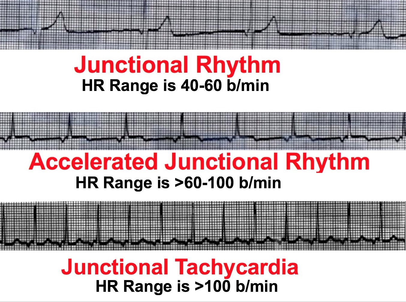 <p>Junctional or ventricular.</p>