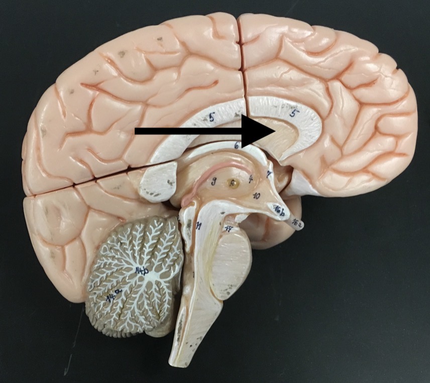 <p>What is the arrow pointing to?</p>