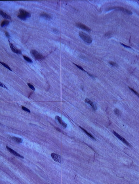 <p>What are the pink lines?</p>