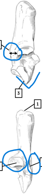 <ul><li><p>gap between medial process and edge </p></li><li><p>depression</p></li><li><p>pointed process</p></li><li><p>single articular facet</p></li></ul><p></p><p>pig calcaneus</p><p></p>