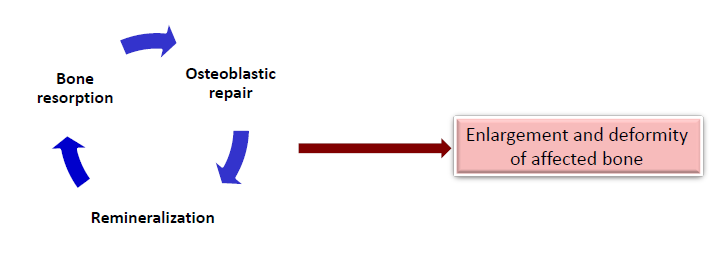 <ul><li><p>another name: osteitis deformans</p></li><li><p>a chronic metabolic bone disease</p></li><li><p>most common in men over the age of 50 </p></li><li><p>pelvis and spinal column</p></li><li><p>jaws: maxilla> mandible </p></li></ul><p></p>
