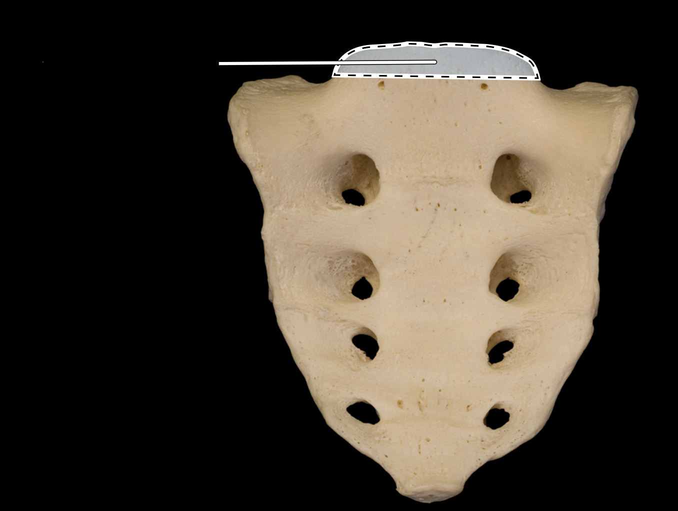 <p>anterior view</p>
