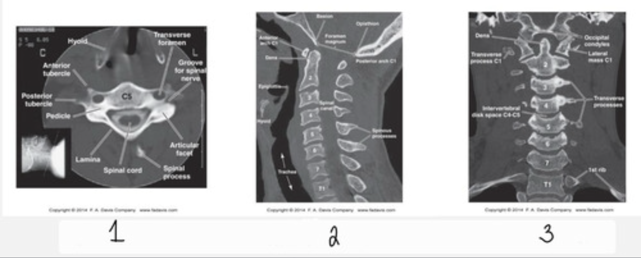 <p>What type of CT view does 3 show?</p>