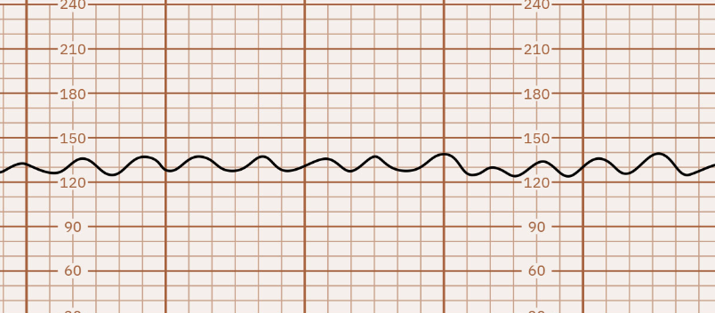 <p>this is showing </p>