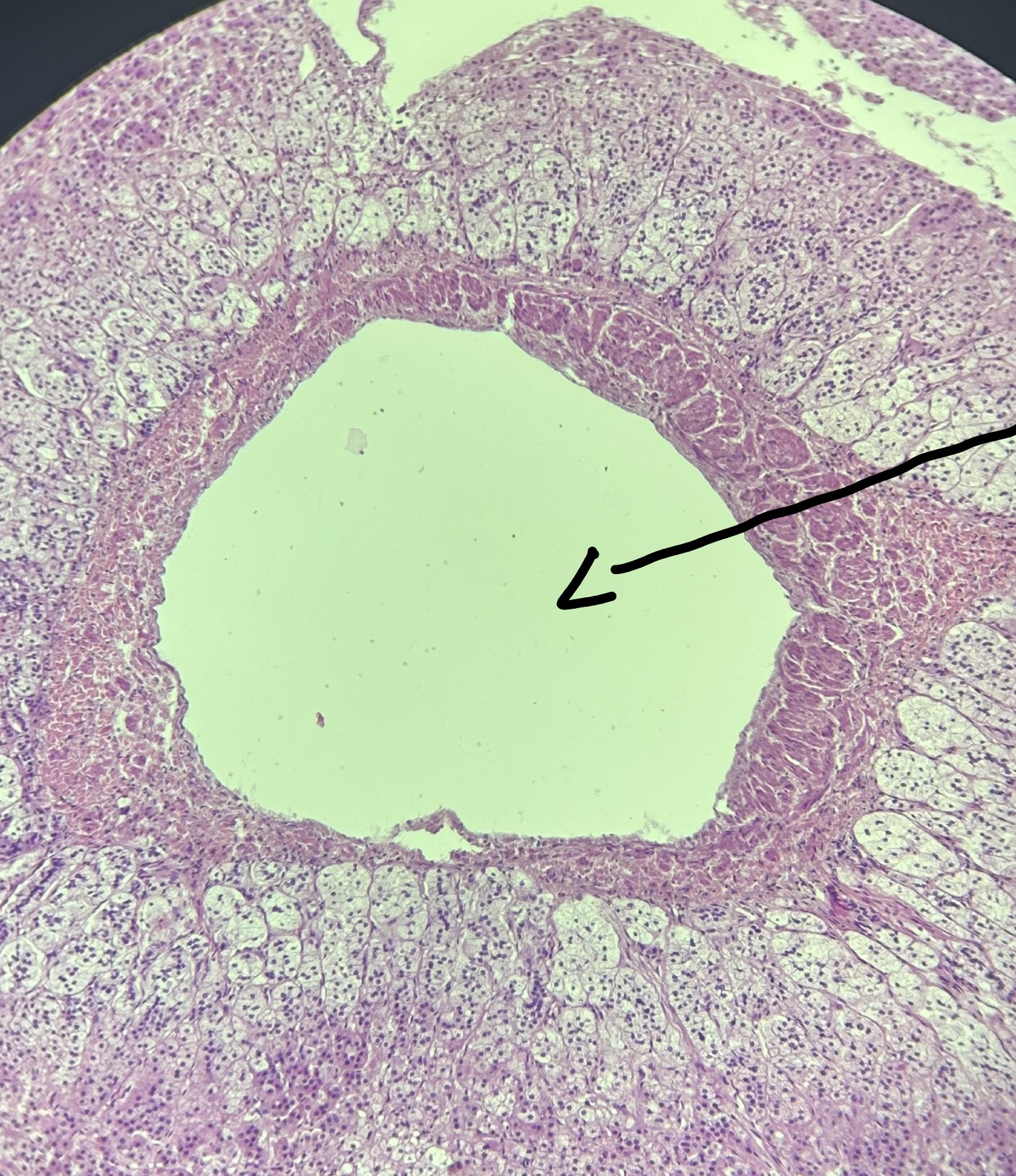 term image