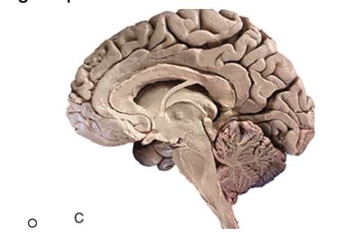 <p>splits brain into right and left</p>