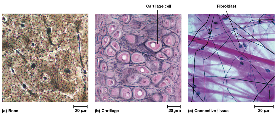<ol><li><p><strong>Bone:</strong> Bone consists mainly of a rigid extracellular matrix that contains a small number of interspersed cells</p></li><li><p><strong>Cartilage:</strong> is a tissue constructed mostly of matrix materials that is more flexible than bones</p></li><li><p><strong>Connective Tissue:</strong> surrounding glands and blood vessels is relatively gelatinous and contains interspersed fibroblast cells</p></li></ol><p></p>