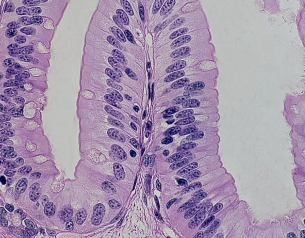 <p>Name the epithelium and give example </p>
