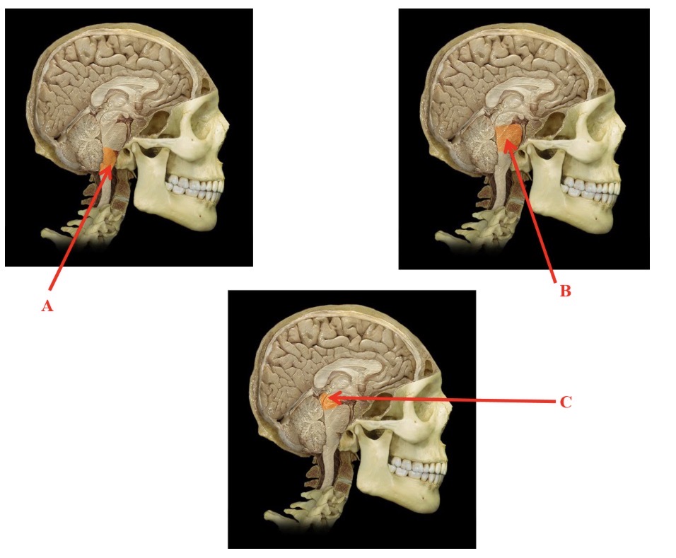 <p>B</p>
