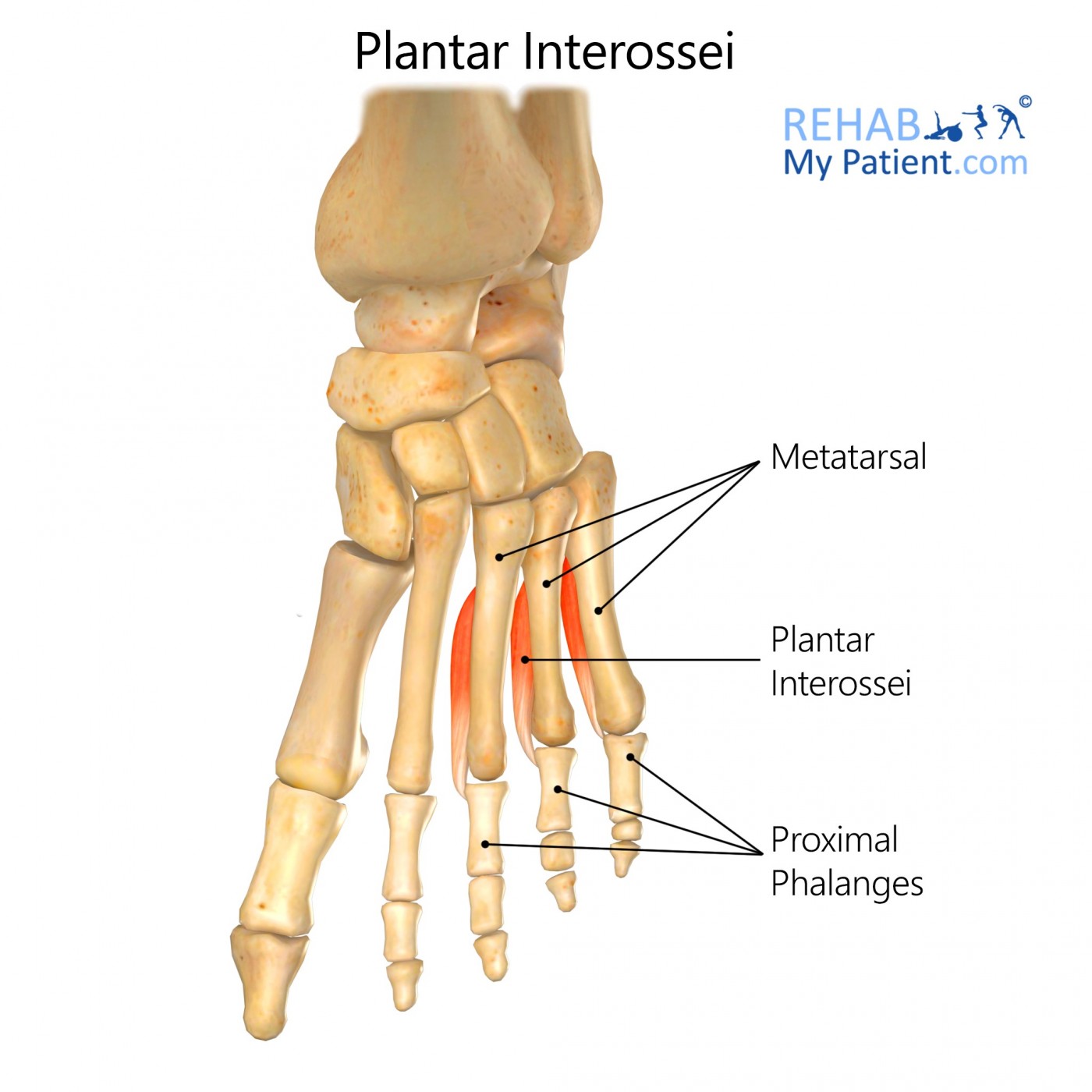 <p>Proximal Attachment (O): Plantar aspect of medial sides of shafts of metatarsals 3–5</p><p>Distal Attachment (I): Medial sides of bases of phalanges of 3rd–5th digits</p><p>Innervation: Lateral plantar nerve (S1–S3)</p><p>Action: Adduct and flex digits 3–5 at MTP joints</p>