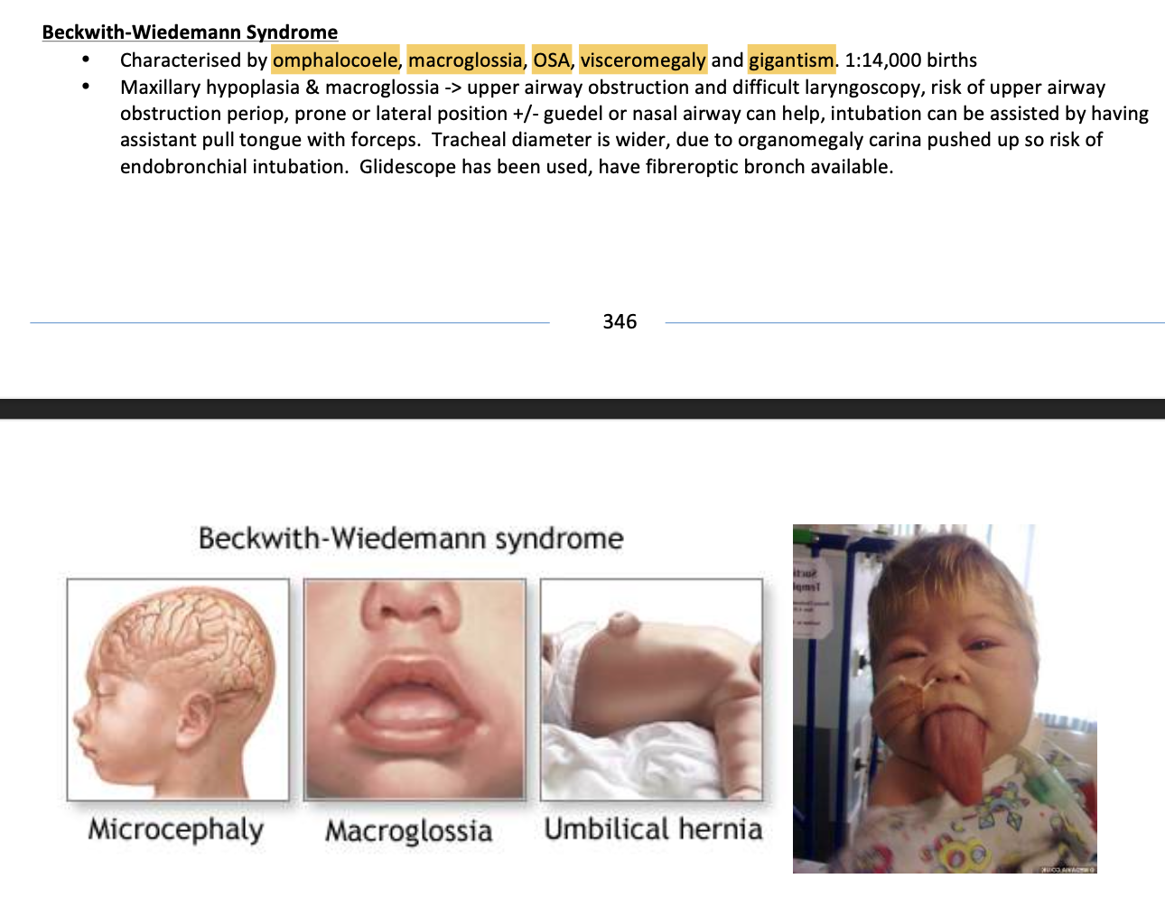 <p>Omphalocoele - organs grow outside the body</p>