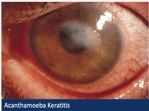 <p>Describe image + give diagnosis?</p>