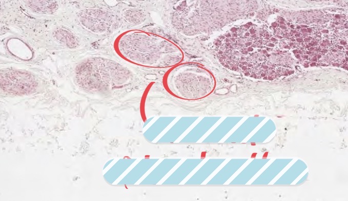 <p>What structure is circled here?</p>