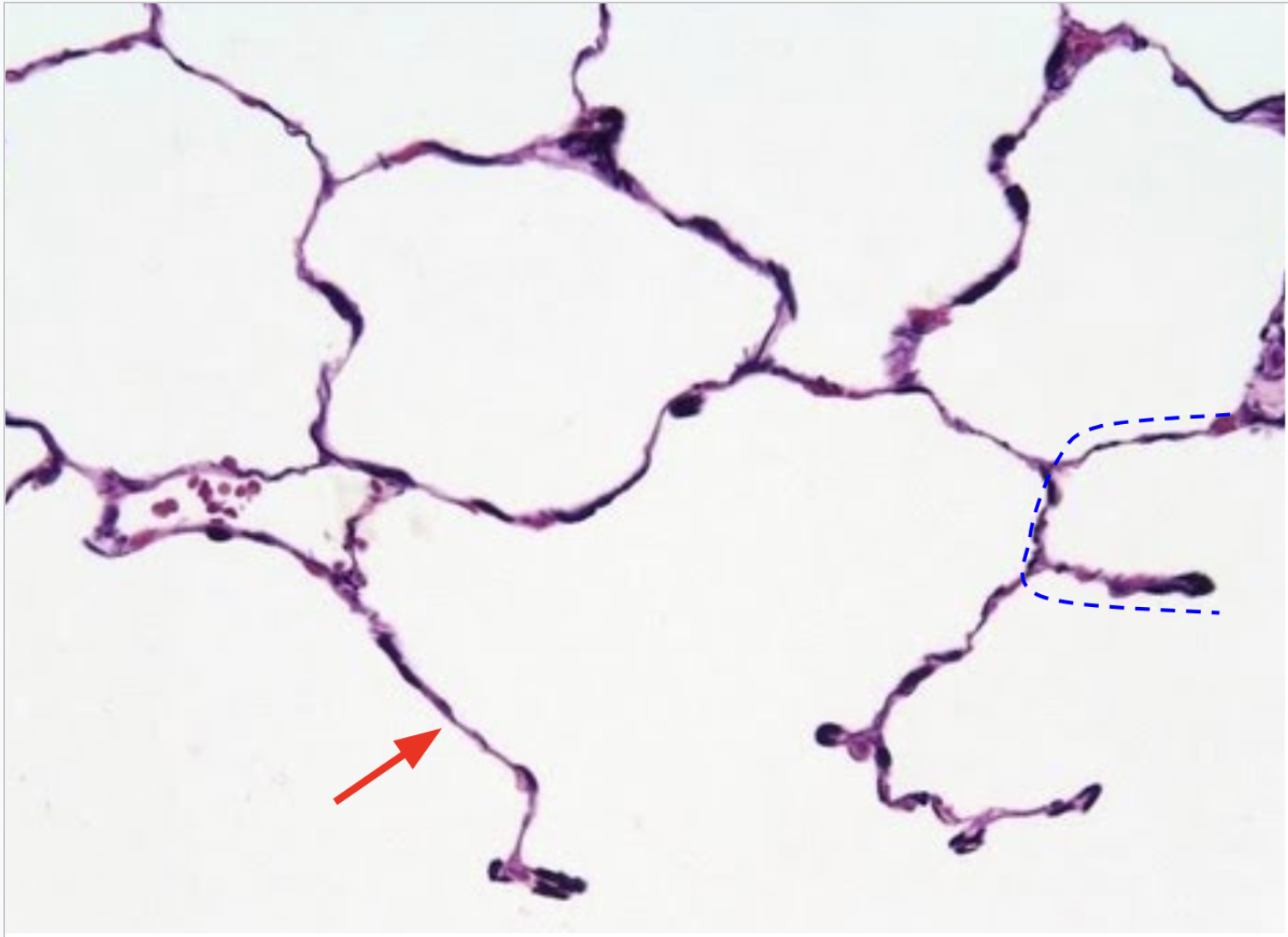<p>Aveoli in the lungs</p><p>Red: Simple squamous epithelium</p><p>Blue: Aveolus - function is diffusion</p><p></p>