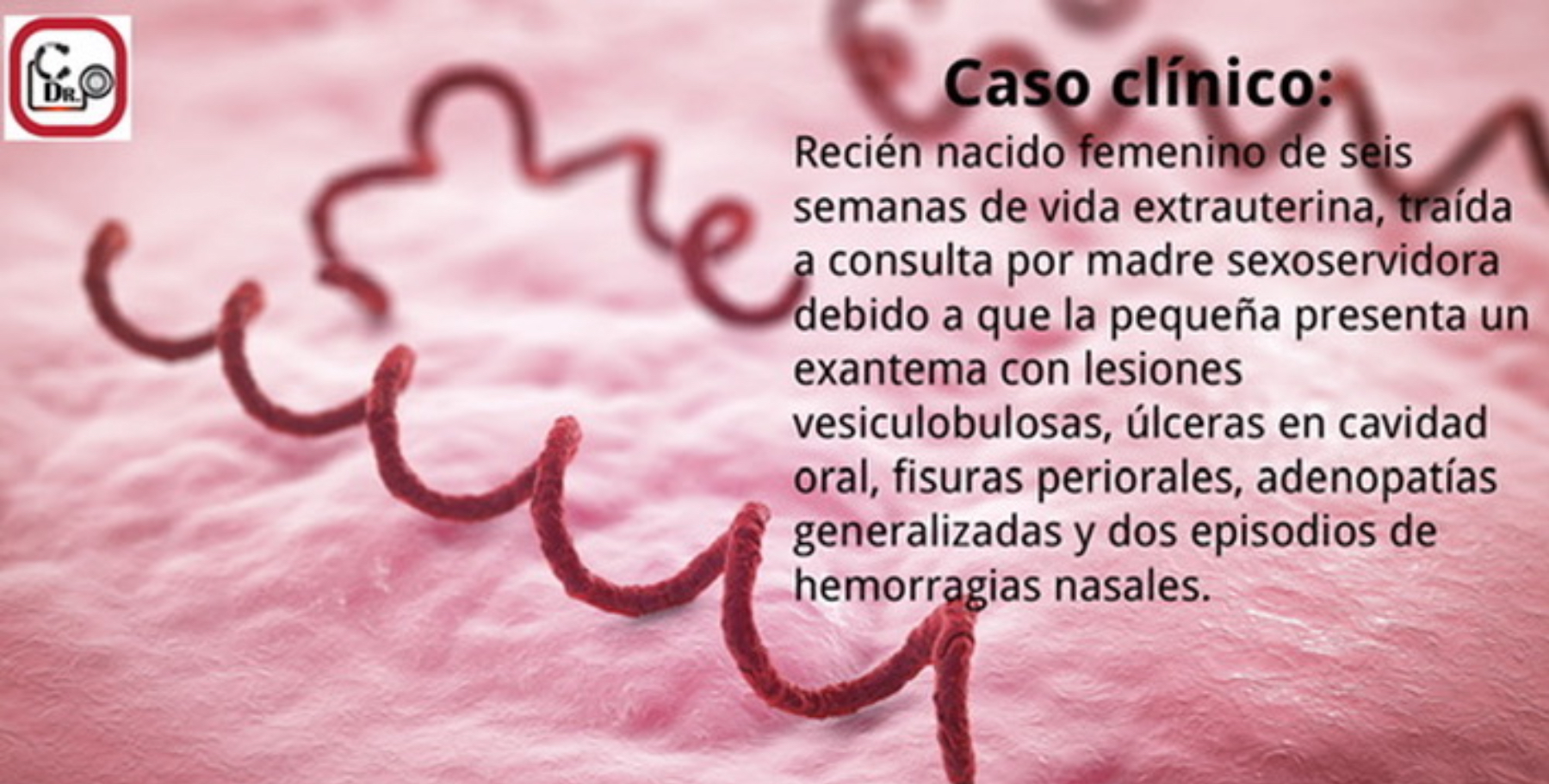 <p>Caso clínico no. 6</p>
