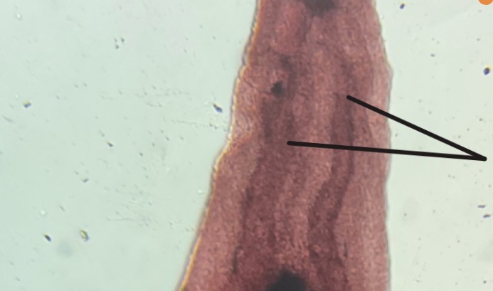 <p>What is this structure </p>