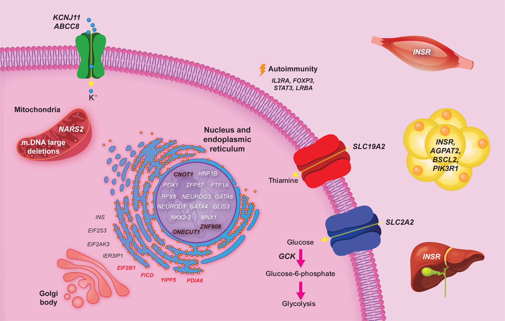 <p>Transient neonatal diabetes mellitus (TNDM) is a rare, temporary monogenic condition appearing in the first weeks of life. About 90% of cases stem from chromosome 6q24 imprinting defects (overexpressing paternal genes PLAGL1 and HYMAI) or mutations in potassium channel genes (KCNJ11 and ABCC8). Symptoms typically resolve by 18 months. It is characterized by <mark data-color="purple" style="background-color: purple; color: inherit;">elevated blood sugar levels</mark> due to <mark data-color="red" style="background-color: red; color: inherit;">insulin deficiency. </mark></p><p>symptoms: </p><ul><li><p>hyperglycemia</p></li><li><p>severe dehydration</p></li><li><p>low birth weight 2/2 IUGR</p></li><li><p>poor weight gain</p></li><li><p>rare ketoacidosis </p></li></ul><p></p>