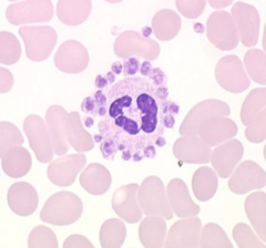 <p>How many platelets are involved in order to call satellitism?</p>