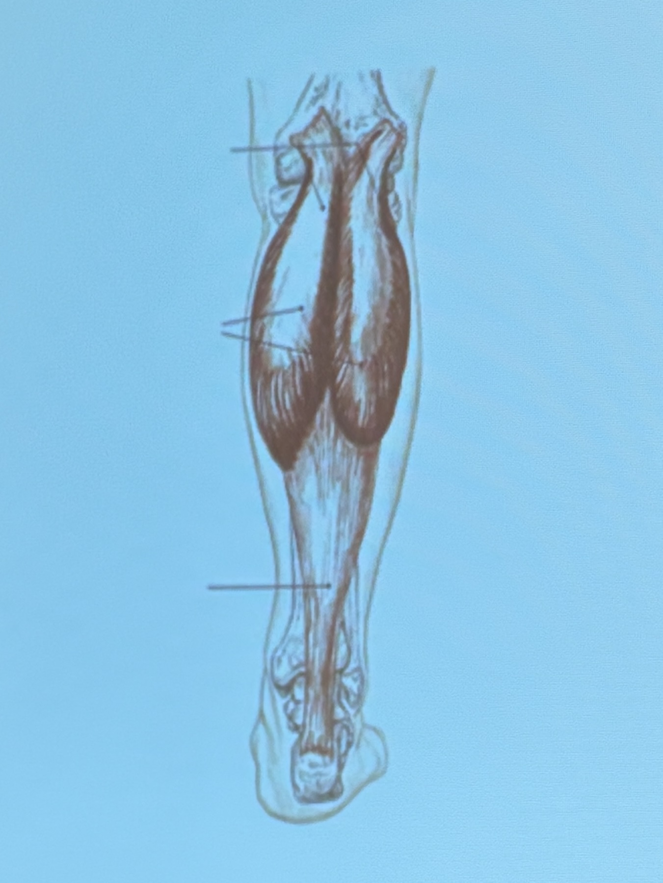 <p>Muscle name?</p>