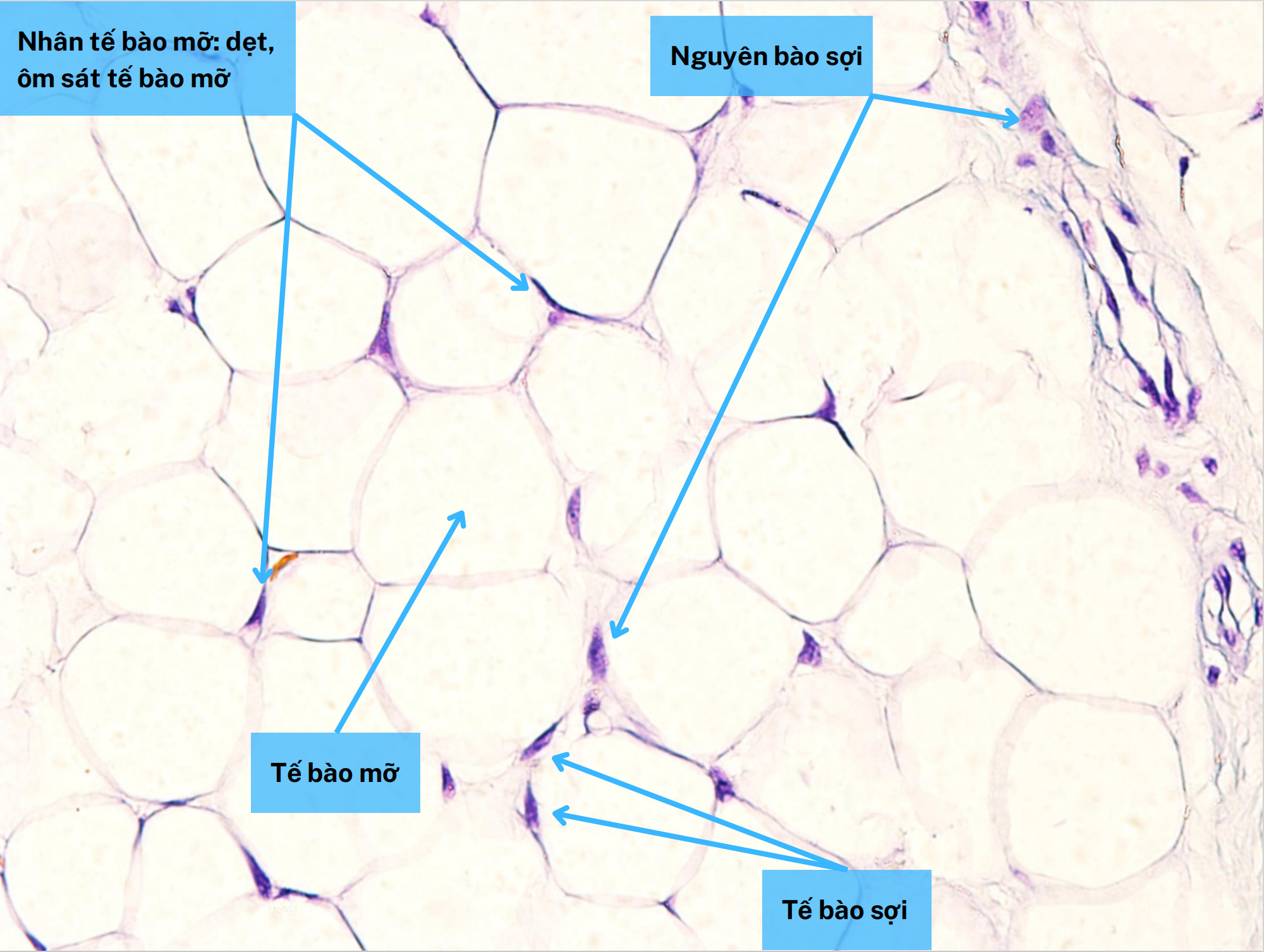 <ol><li><p>Nhân tế bào mỡ</p></li><li><p>Tế bào mỡ</p></li><li><p>Nguyên bào sợi</p></li><li><p>Tế bào sợi</p></li></ol><p></p>
