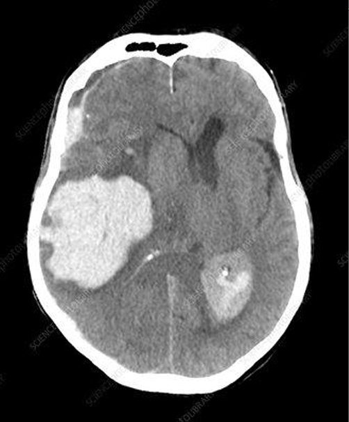 <p>diagnosis</p>