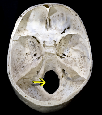 <p>Large hole for spinal cord</p>