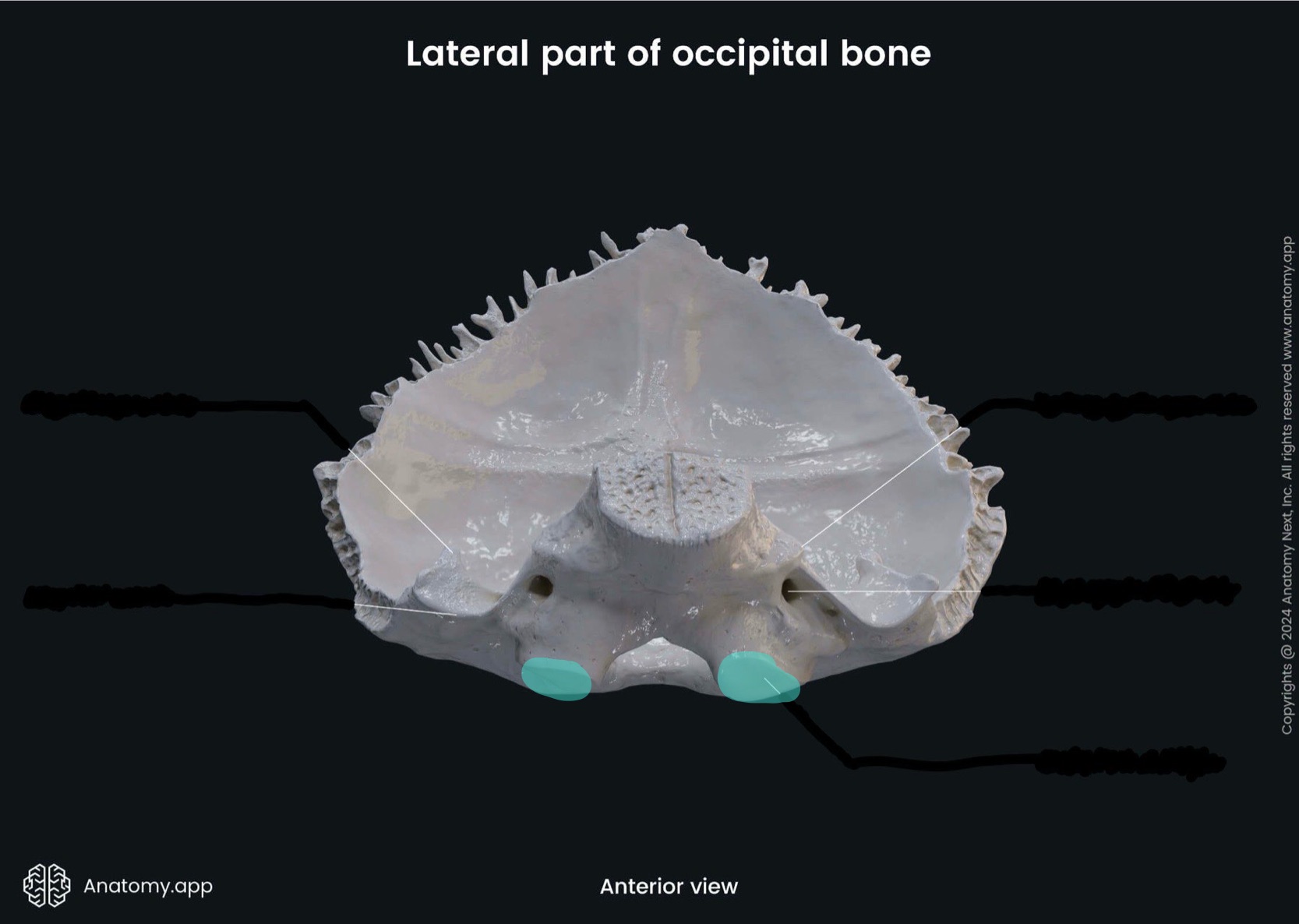 <p>What is the highlighted bony landmark</p>