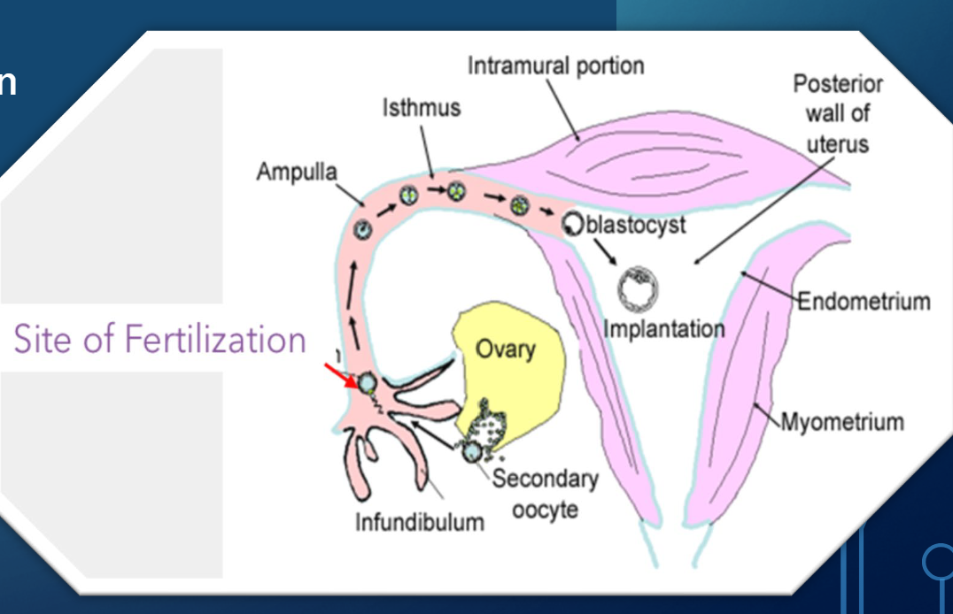 <p>1) Development begins with fertilization (usually occurs in ampulla of fallopian tube)</p><p>2) Haploid (1n) gametes (sperm and oocyte) fuse to form diploid (2n) zygote</p><p>• Oocyte from female: 22 autosomal chromosomes + 1 sex chromosome (X)</p><p>• Sperm from male: 22 autosomal chromosomes + 1 sex chromosome (X or Y)</p><p>• Genetic male zygote: XY</p><p>• Y chromosome carries SRY gene that dictates testis differentiation</p><p>• Genetic female zygote: XX</p><p>• Absence of SRY gene ovary developme</p>
