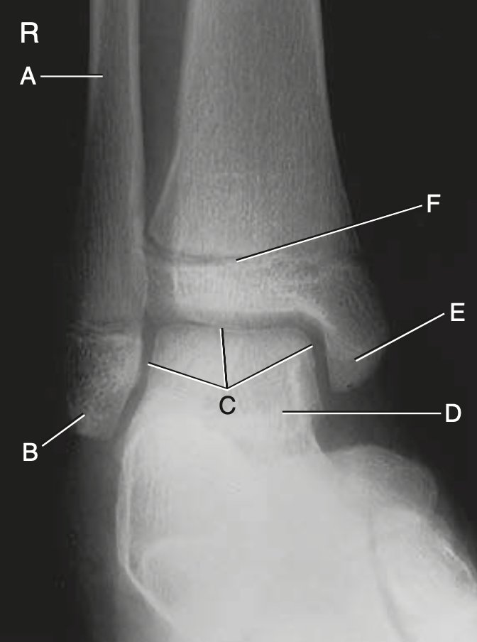 <p>F</p>